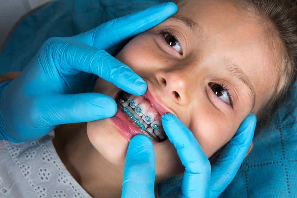 appareil dentaire orthodontie enfant dents
